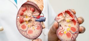 Chronic Kidney Disease (CKD): causes, risk factors, and CKD stages explained.