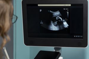 gynecologist-performing-ultrasound-consultation